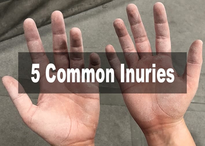 5 Common Injuries in Climbing and How To Prevent Them